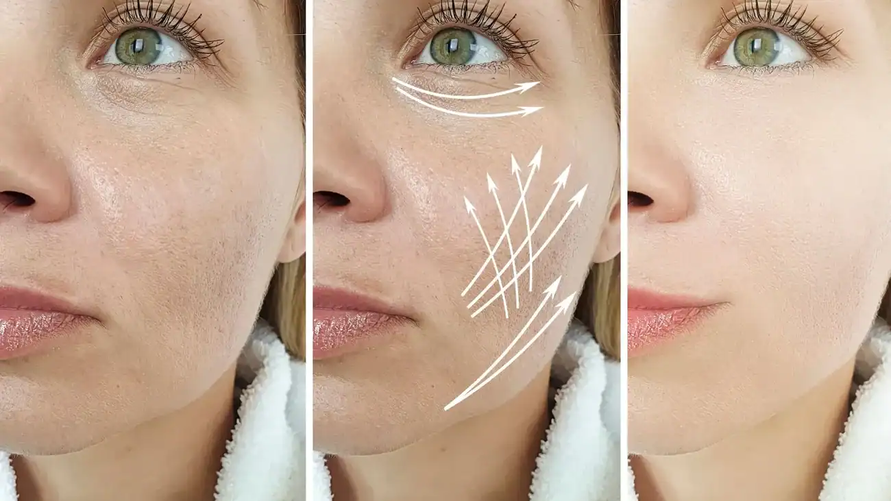Can One Treatment Really Tackle More Than One Skin Concern Underwood?