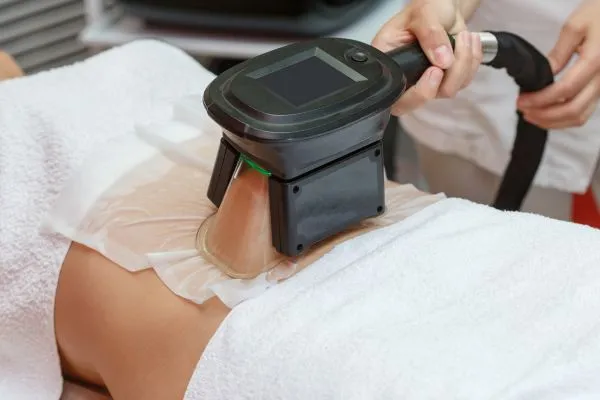 Image of person having fat freezing treatment to help weight gain Underwood