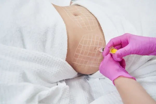 image of fat dissolving injections on love handles to help combat weight gain Underwood