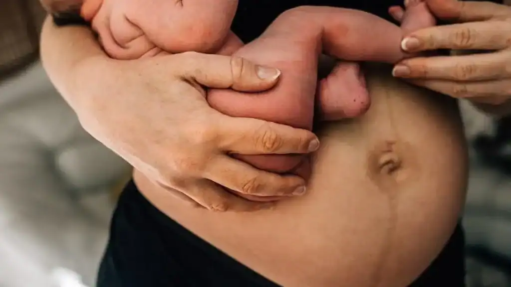 Why Is My Stomach Still Big After Pregnancy Underwood?